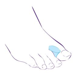 СТ-31 Межпальцевая перегородка СТ-31 Межпальцевая перегородка