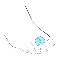 СТ-54.3 Межпальцевая перегородка с кольцом СТ-54.3 Межпальцевая перегородка с кольцом