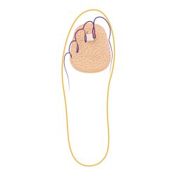 СТ-221 Корректор 1 пальца СТ-221 Корректор 1 пальца