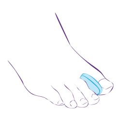 СТ-32 Межпальцевый вкладыш СТ-32 Межпальцевый вкладыш