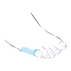 СТ-48 Приспособление разгружающее СТ-48 Приспособление разгружающее