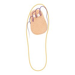 СТ-222 Корректор 2 пальцев СТ-222 Корректор 2 пальцев