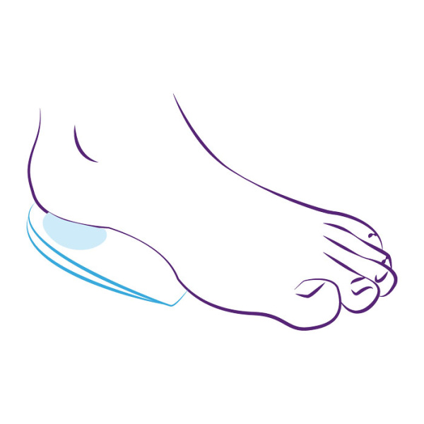 Подпяточники ортопедические силиконовые СТ-40  Trives Подпяточники ортопедические силиконовые СТ-40  Trives