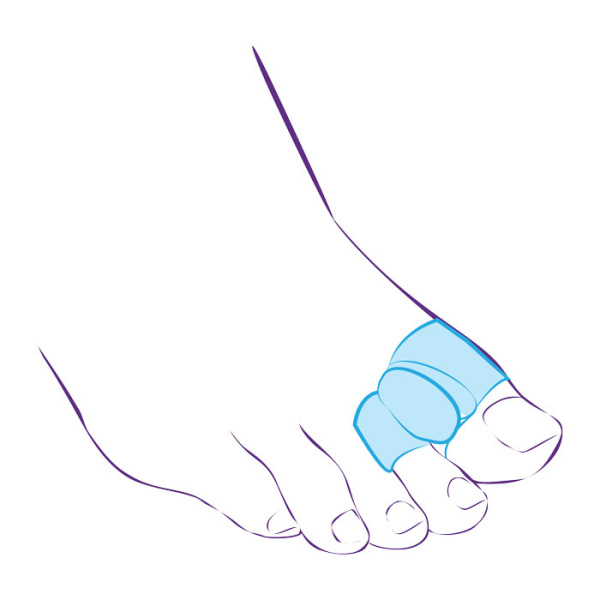 Межпальцевая перегородка с кольцами на 1-й и 2-й пальцы СТ-54.2  Trives Межпальцевая перегородка с кольцами на 1-й и 2-й пальцы СТ-54.2  Trives