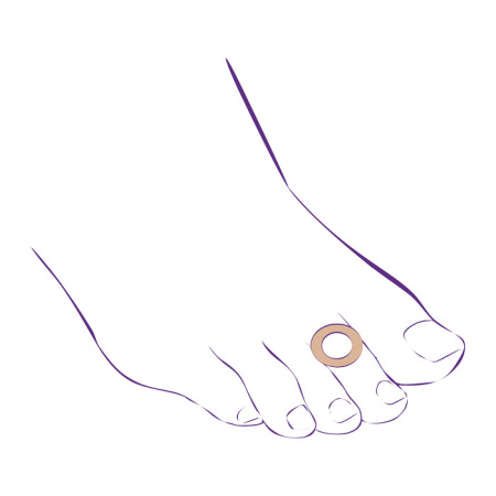 Протектор-кольцо от мозолей СТ-63  Trives Протектор-кольцо от мозолей СТ-63  Trives