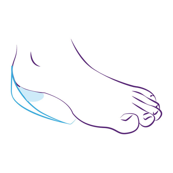 Подпяточники ортопедические силиконовые с бортиками СТ-41  Trives Подпяточники ортопедические силиконовые с бортиками СТ-41  Trives