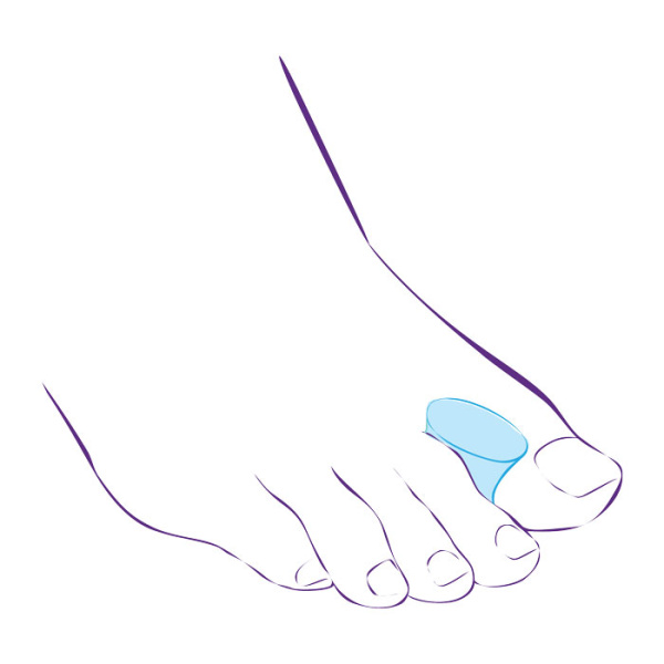 Межпальцевая перегородка СТ-31  Trives Межпальцевая перегородка СТ-31  Trives